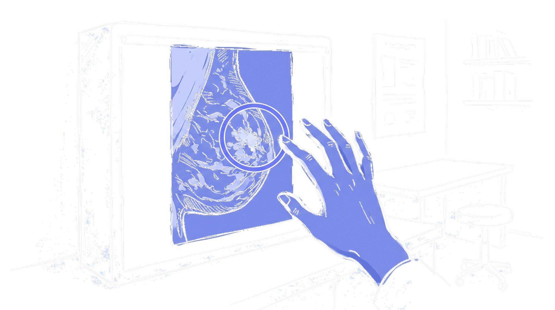 Handgezeichnete Skizze eines Mammogramms mit KI-Overlay-Markierung